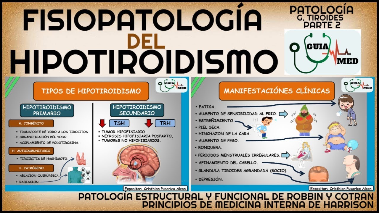 HIPOTIROIDISMO FISIOPATOLOGÍA GuiaMed YouTube