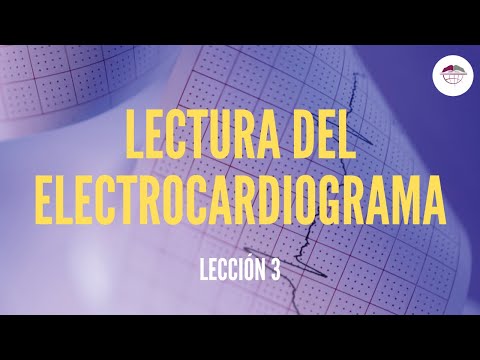 Como hacer un electrocardiograma