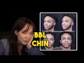 Cinna calls YourRageGaming about his chin