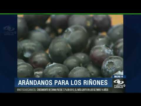 Video: ¿El jugo de uva ayuda a los cálculos renales?