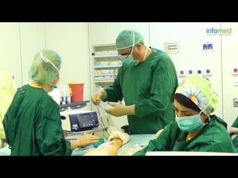 ד"ר אנטוניו ריינה  - כירורג כלי דם