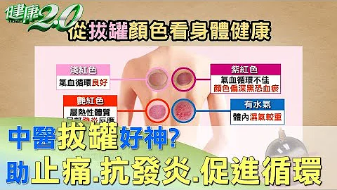 奧運選手瘋拔罐！泳將飛魚:放鬆肌肉 拔罐真有效 健康2.0 - 天天要聞