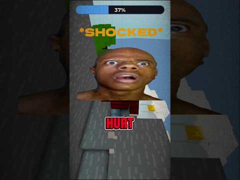 Why'd you do that🦷