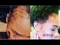 How to grow your edges back in 4 weeks