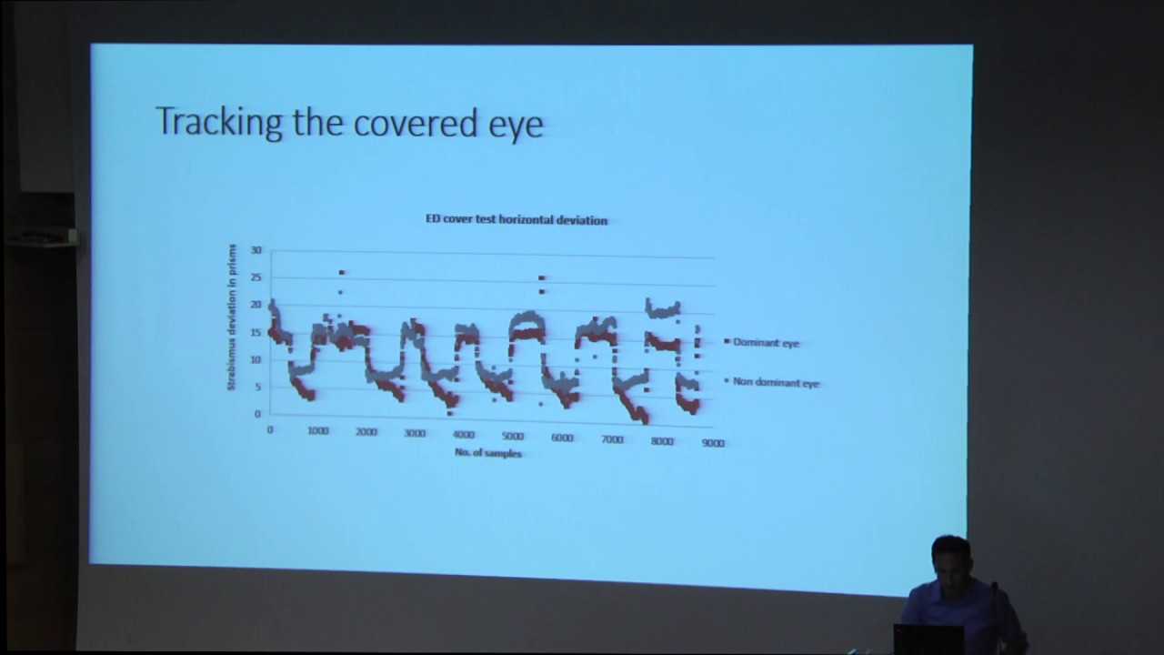 A method for rapid objective strabismus angle measurement - Dr. Oren Yehezkel