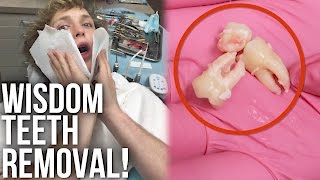 GETTING MY WISDOM TEETH REMOVED!(Watch Yesterday's Vlog ▻ https://youtu.be/3AllP2NJmhE Today I got my wisdom teeth removed and turned into a complete savage hahaha SUBSCRIBE FOR ..., 2016-12-23T18:46:20.000Z)