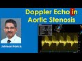 Doppler Echocardiography in Aortic Stenosis