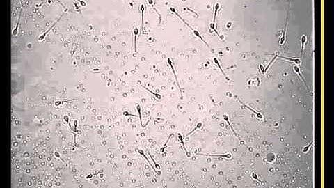 Sperm Videos Recorded Through V-Sperm on the SQA-V Automated Semen Analyzer