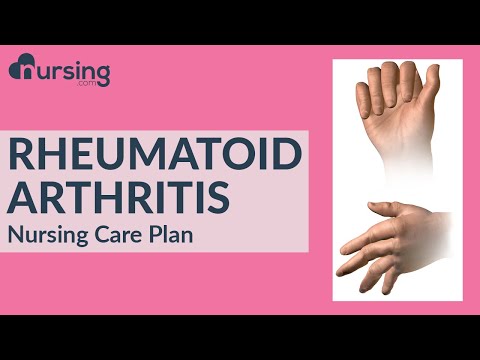 Care Plan for Rheumatoid Arthritis (Nursing Care Plan)