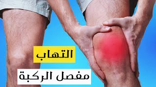 علاج التهاب مفصل الركبة