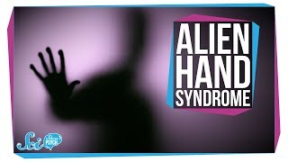 Alien Hand Syndrome: When a Limb Goes Rogue