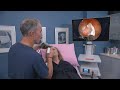 Watch Cryotherapy to Treat Chronic Nasal Congestion