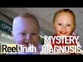 The Boy With Unexplained Seizures (Mystery Diagnosis) | Medical Documentary | Reel Truth