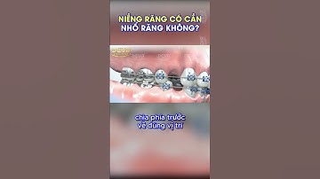 Niềng răng có phải nhổ răng không? #shorts #nhakhoa