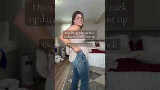 Its Been A While Since I Did An Tummy Tuck Update And Lets Just Say Maybe Wait A Bit After The