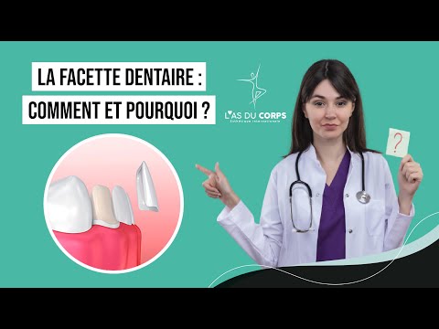 Facettes dentaires