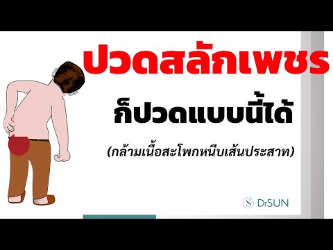 ปวดสลักเพชรก็ปวดแบบนี้ได้/ อาการปวดสลักเพชร กล้ามเนื้อสะโพกหนีบเส้นประสาท/หมอซัน