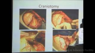 Pterional Craniotomy