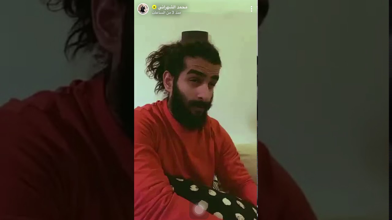سنابات التوام الشهراني سوى التحدي غصب وجهه عبدالله اخر شي 😭😂❤️