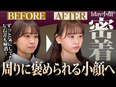 【どこから撮っても盛れ顔】1day小顔®︎で気になる左右差を改善！周りに褒められる綺麗なフェイスラインに！