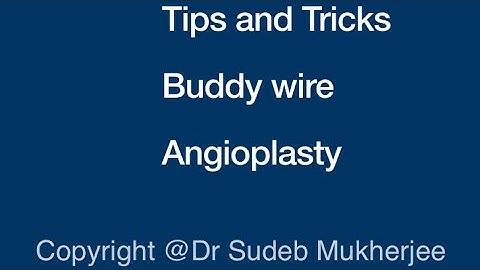 Angioplasty Buddy Wire Tips and Tricks