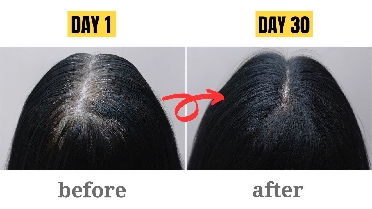 5 Proven Ways to Transform Thin Hair into Thick | Ultimate Hair Growth ...