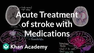Acute treatment of stroke with medications | NCLEX-RN | Khan Academy