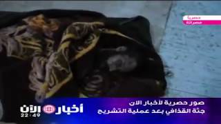 صور حصرية لأخبار الان جثة القذافي بعد عملية التشريح
