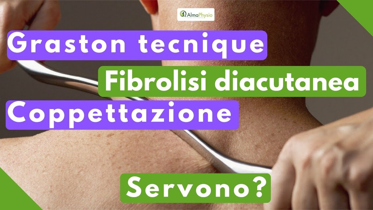 graston tecnique, fibrolisi diacutanea, coppettazione: servono? postural defects