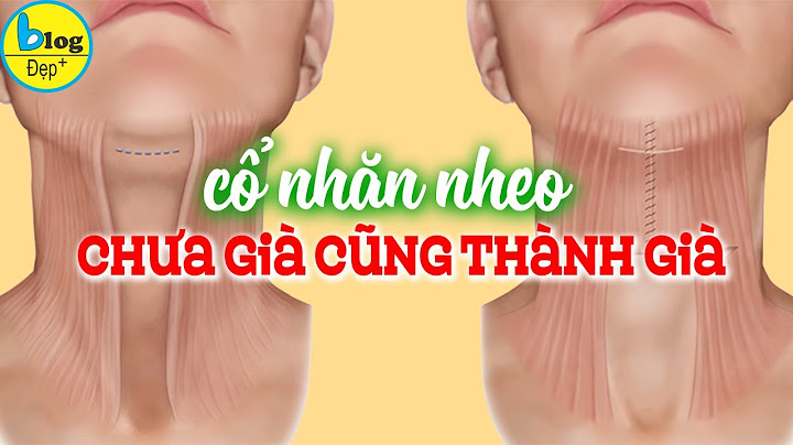 Làm thế nào để trắng da vùng cổ năm 2024