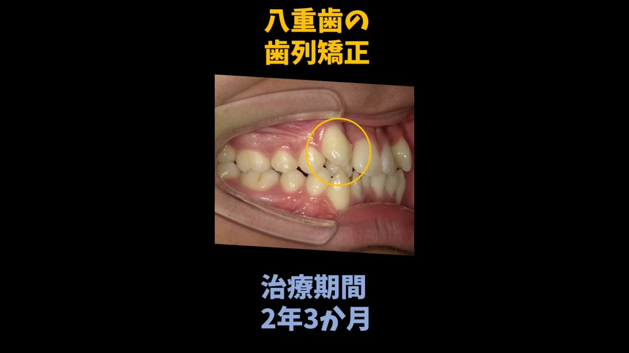 hq720_2.jpg?sqp=-