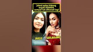 Download lagu After plastic surgery, DENADA's face changed drastically.
