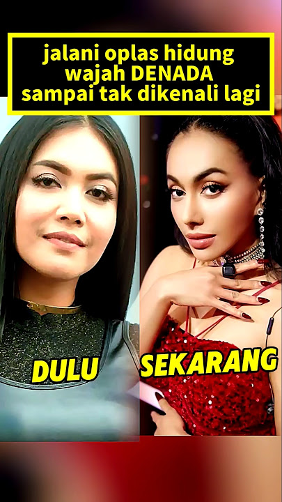 usai oplas wajah DENADA berubah drastis