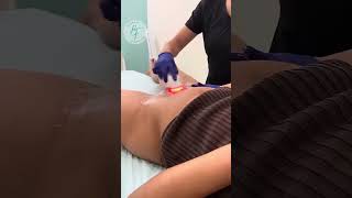 Bikini Bleaching | Skin Lightening Treatment @ Bare Fruit Sugaring and Brows