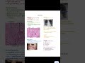 Sarcoidosis.     #neetpg2026preparation #highyield #mbbs #neetpgexam #neetpg2026 #medicalstudent #