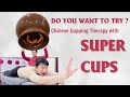This is the largest cupping cup in the world.
