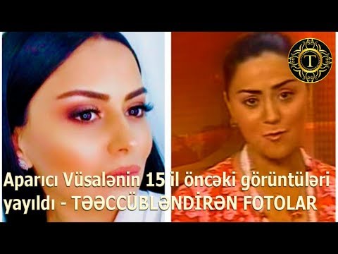 Aparıcı Vüsalənin 15 il öncəki görüntüləri yayıldı  TƏƏCCÜBLƏNDİRƏN FOTOLAR