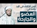 ليس الخلاف في اليد وإنما في العضو والجارحة
