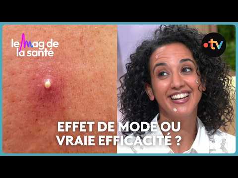 Are pimple patches actually effective against acne?