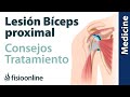 Consejos para el tratamiento de las lesiones del tendón del bíceps proximal