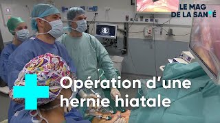 Hernie hiatale : quand l'opération devient nécessaire - Le Magazine de la Santé