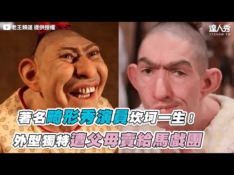 【著名畸形秀演員坎坷一生！外型獨特遭父母賣給馬戲團】｜@老王頻道