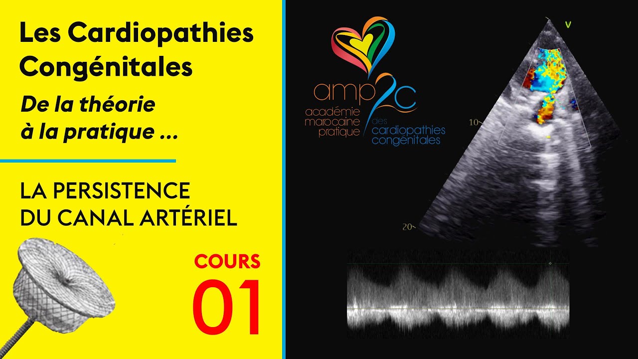 Cours AMP2C : la PCA