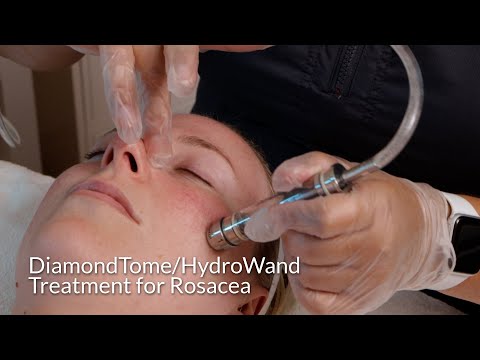 Skin Barrier Repair Treatment for Rosacea Skin - video from Altair Instruments