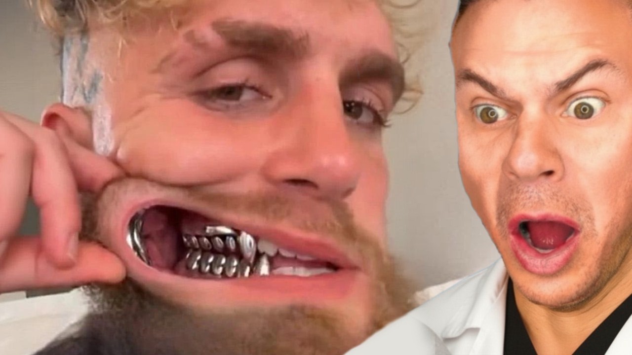You Are NOT Ready For These Dental Videos