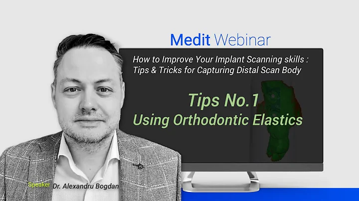 How to Improve Your Implant Scanning Skills / Tips No.1: Using Orthodontic Elastics