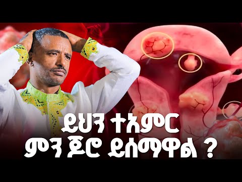 አቤት የእግዚአብሔር ተአምር መሰማት ያለበት አስደናቂ ተአምር