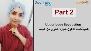 عملية شفط الدهون بكوريا الجزء الثاني -  Liposuction at 365mc hospital with Docfinderkorea part 2