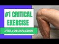 #1 Critical Exercise After Knee Replacement