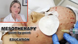 Mesotherapy for face- full demo and point by point injection technique screenshot 4